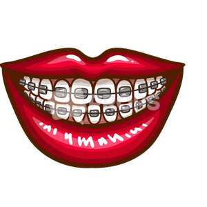 Mouth with Braces